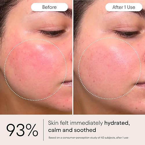 Miniatura 4 de Alpyn Beauty Super Peptide & Ghostberry Hidratante para reparación de eczema, barrera y arrugas  Calma y calma contra el enrojecimiento y la