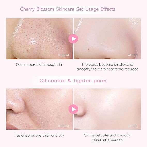Sakura Skincare Set,29PCS Teenager Gifts Girls - Skincare Gift Set,Pamper Sets for Women Gifts,Complete Routine with Cleanser, Toner, Serum, Cream & Masks,Pamper Set