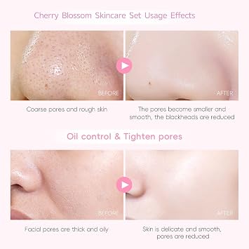 Sakura Skincare Set,29PCS Teenager Gifts Girls - Skincare Gift Set,Pamper Sets for Women Gifts,Complete Routine with Cleanser, Toner, Serum, Cream & Masks,Pamper Set