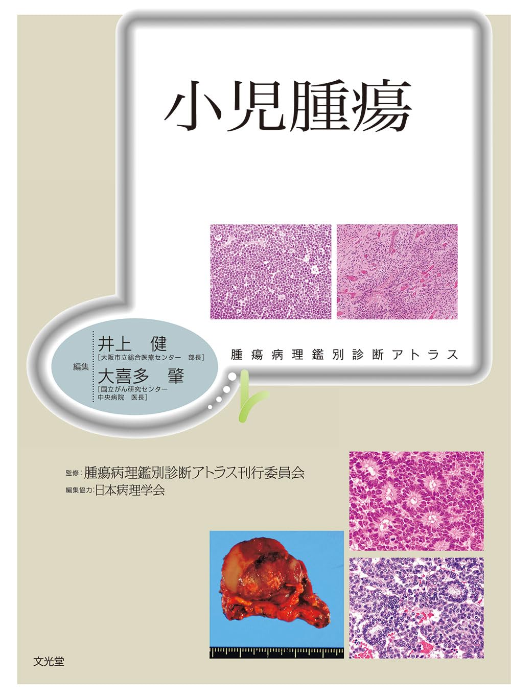 乳癌第3版　腫瘍病理鑑別診断アトラス m3電子書籍 | 腫瘍病理鑑別診断アトラス 乳癌 第3版