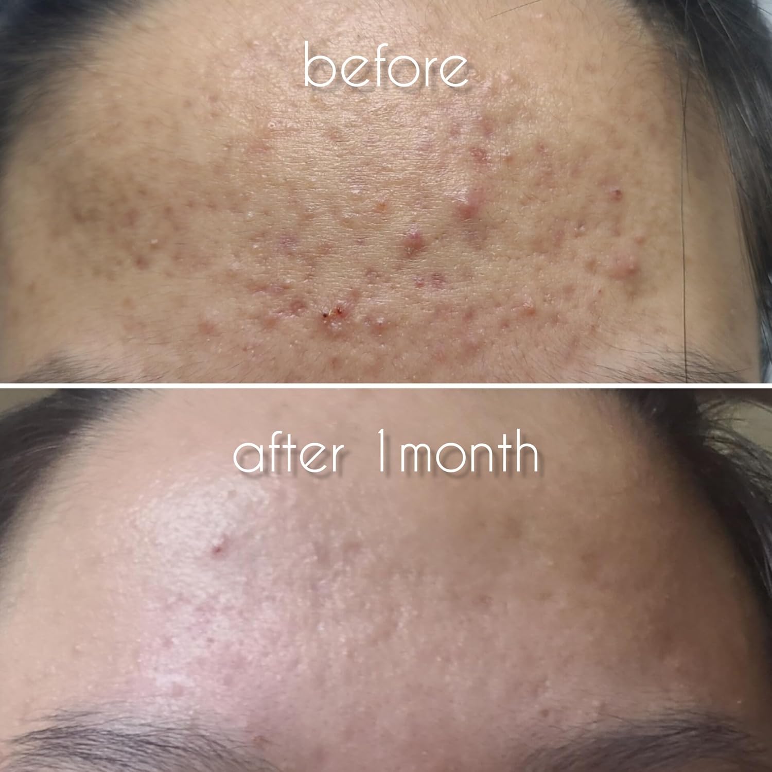 Glyco Peeling Pad Korean 170ml (66 pads) AHA + BHA Dead Skin & Sebum Care Hydrogen Peeling Pads