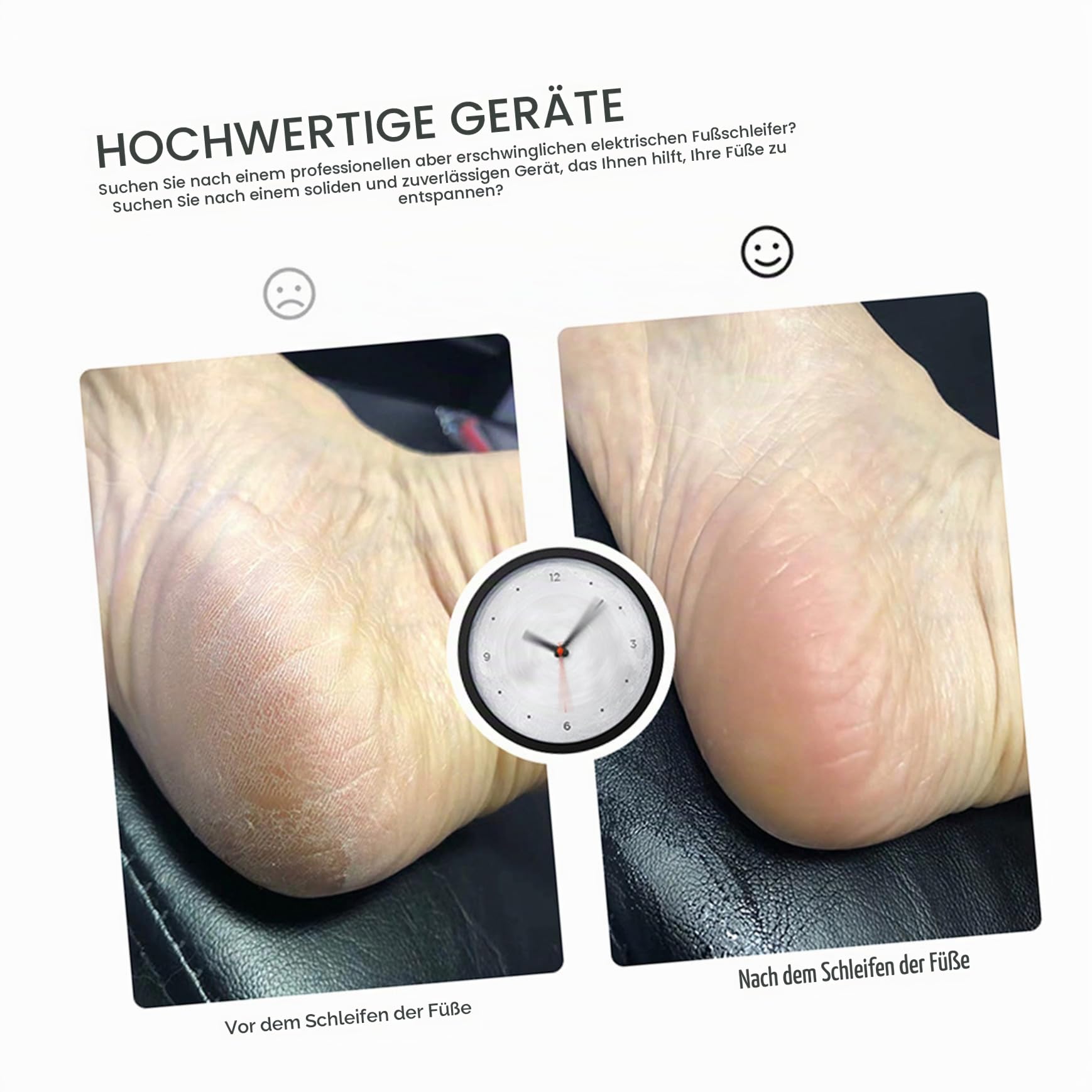 Wiederaufladbarer Elektrischer Hornhautraspel Fußpflegegerät mit PP Quarz Einfache Bedienung und-Knopf Steuerung für Effektive Pediküre Zuhause