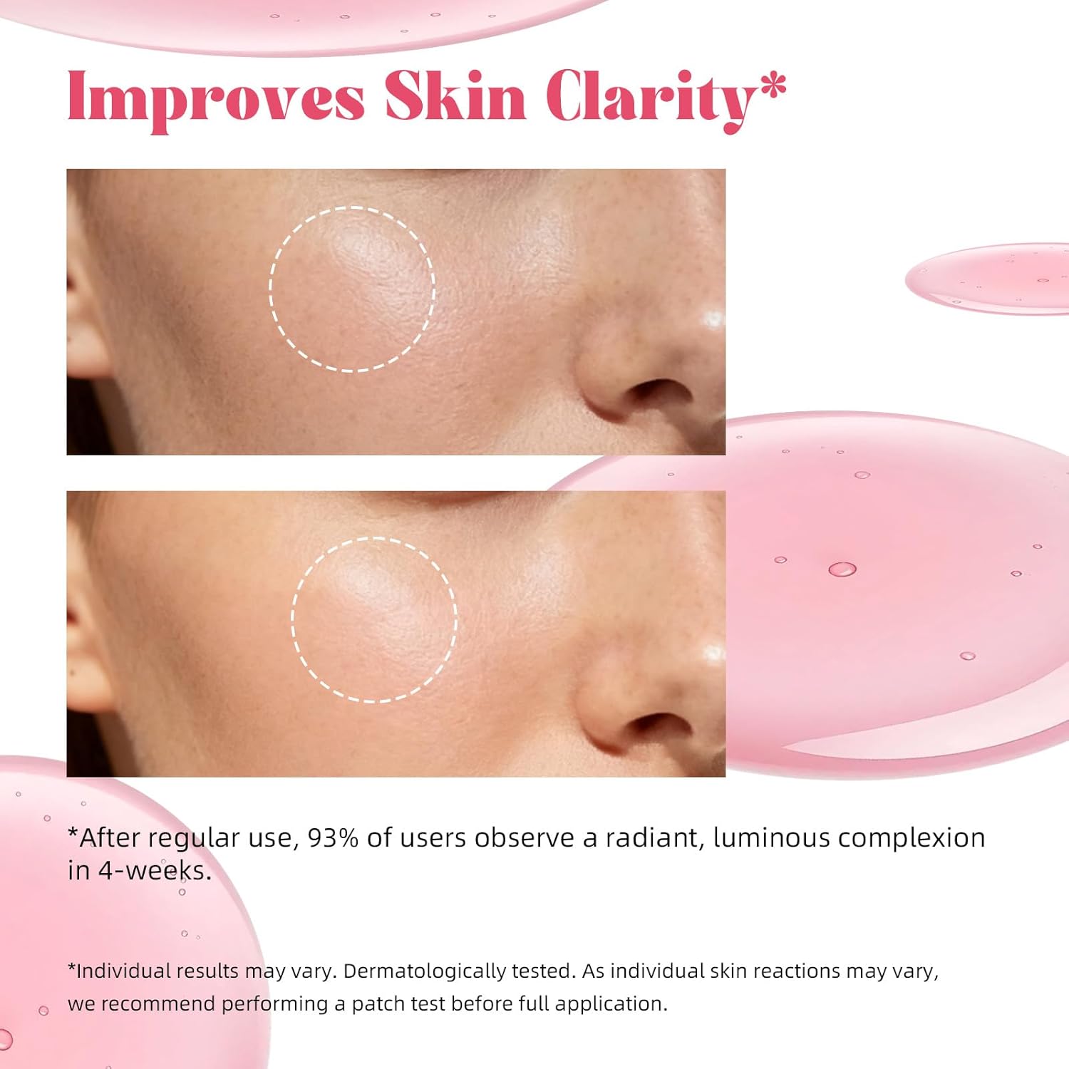 ANRCOLLECT Tranexamic Acid Serum with 5% Txa & 10% Niacinamide, Kojic Acid, Niacinamide Acido Tranexámico Perfect Serum with Hyaluronic Acid, Ceramides, 1 OZ / 30ML, Valentines Day Gifts - Image 6