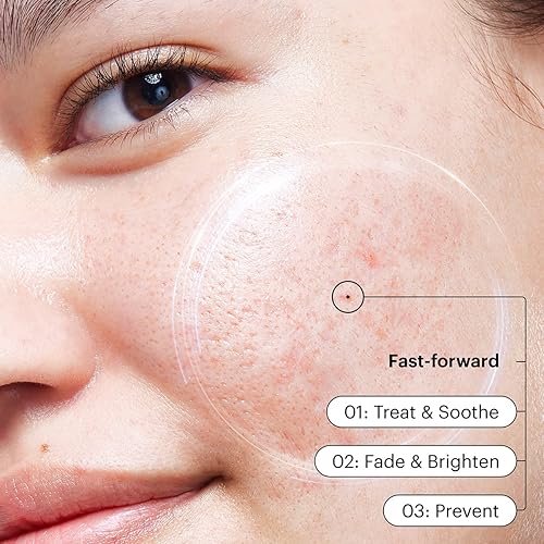 Miniatura 5 de Purposeful Skincare by Allies PSA Silver Lining Dioic & Willowherb Crema Clarificante Hidratante Para Piel Propensa a Manchas Y Brotes 1.7 fl oz1.7