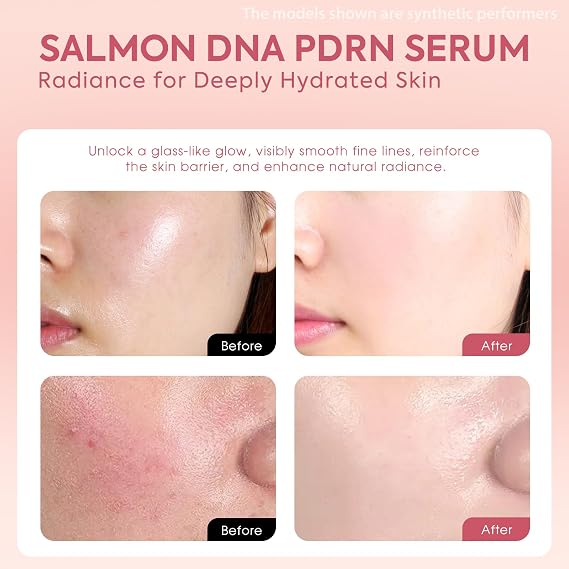 Salmon DNA Serum, 99% PDRN High-Purity Ampoule, Anti-Aging One Day Serum with Recombinant Collagen & Glutathione, Korean Skincare for Wrinkles, Deep Hydration, Firming, Glass Skin, 0.05 fl.oz x 30e