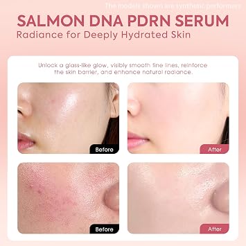 Salmon DNA Serum, 99% PDRN High-Purity Ampoule, Anti-Aging One Day Serum with Recombinant Collagen & Glutathione, Korean Skincare for Wrinkles, Deep Hydration, Firming, Glass Skin, 0.05 fl.oz x 30e