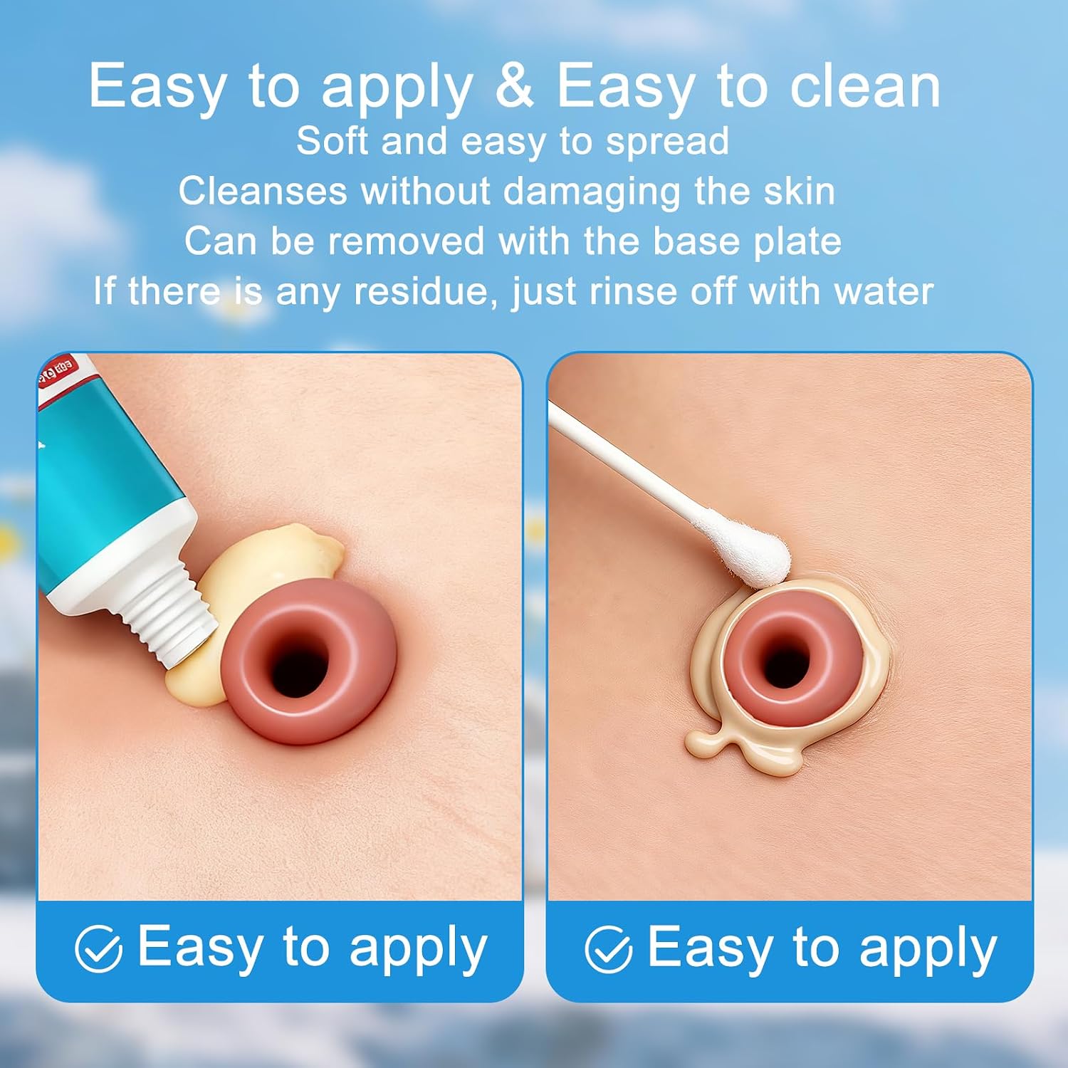 Ostomy Barrier Paste - 2 oz Tube for Leak Prevention, Alcohol-Free Stoma Filling Paste Creates a Protective Seal Around Stoma, Secure Ostomy Supplies for Sensitive Skin