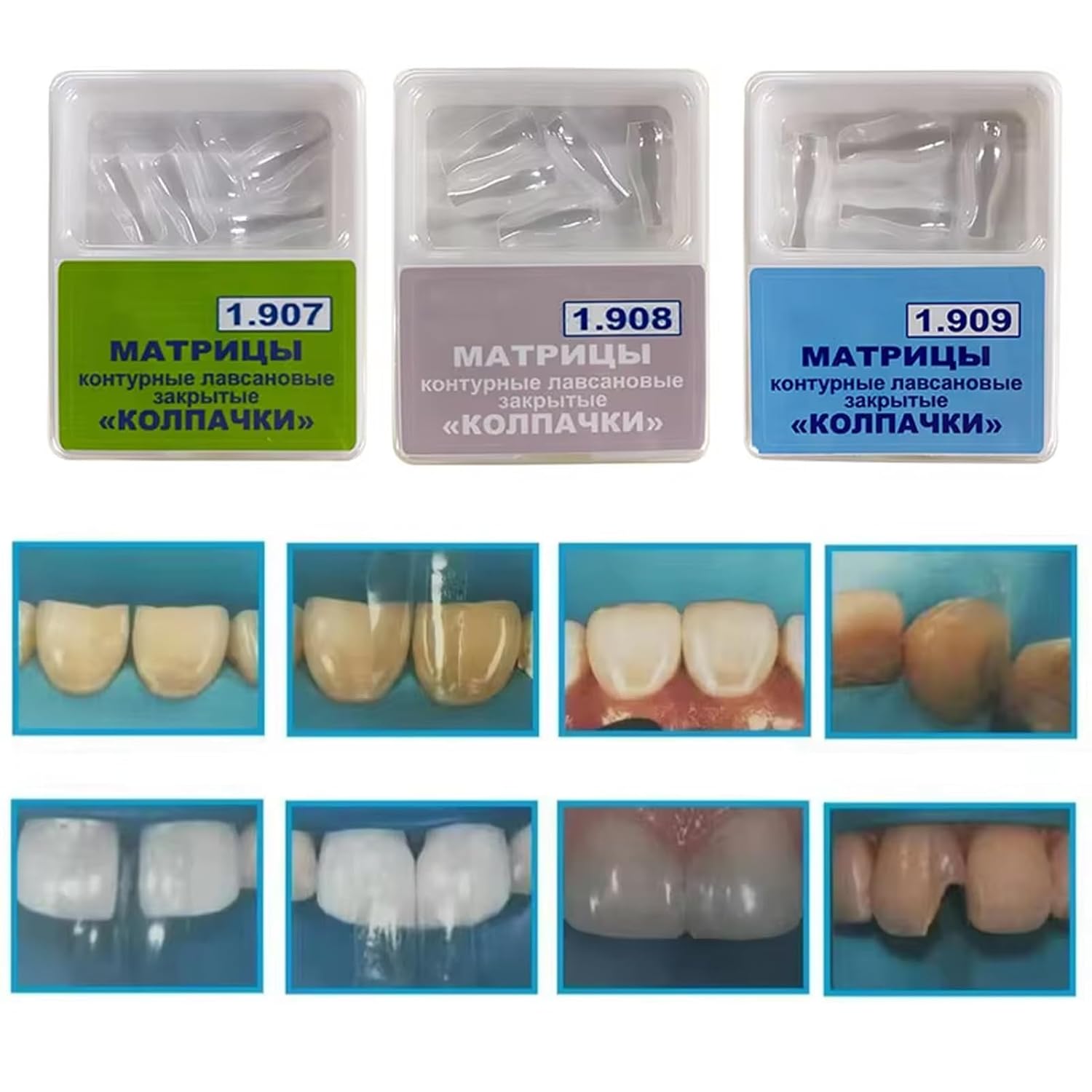 Dental Clear Matrix Bands, BT Anterior Matrices Bioclear Style, Diastema Transparent Sectional Matrice System (1907)