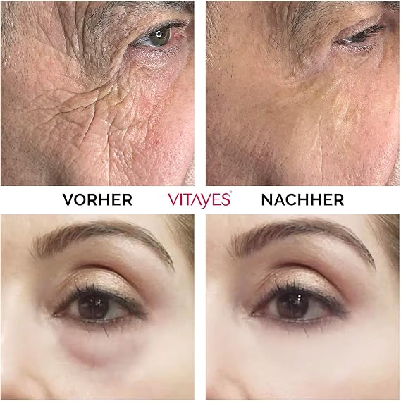 VİTAYES INSTANT AGEBACK Yaşlanma Karşıtı Kırışıklık Giderici Yüz Germe Kremi 7ML