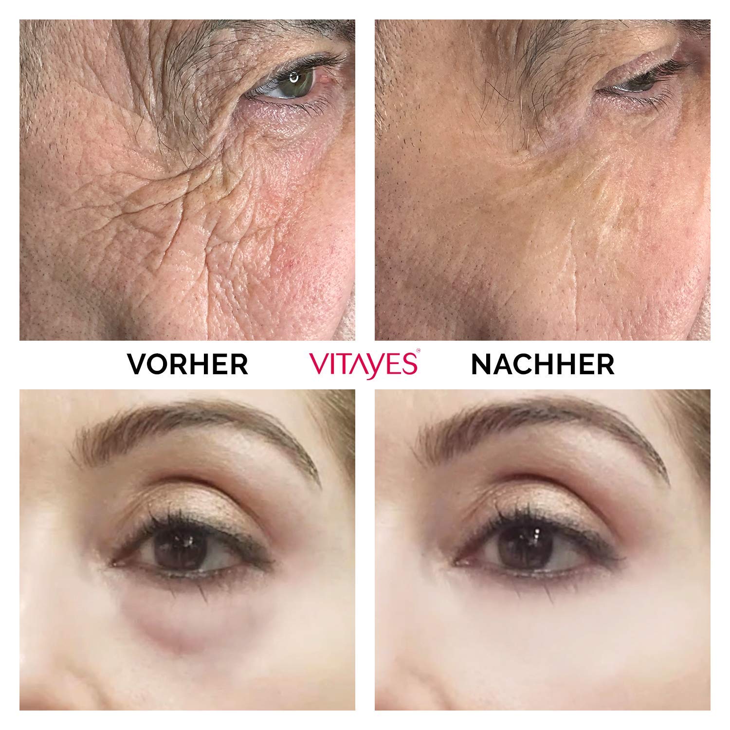 VITAYES Instant Ageback Lifting Cream, Dark Circle Bags Under Eye Remover, Anti Wrinkle and Fine Lines Face Lift Cream 0.24 Oz image 3