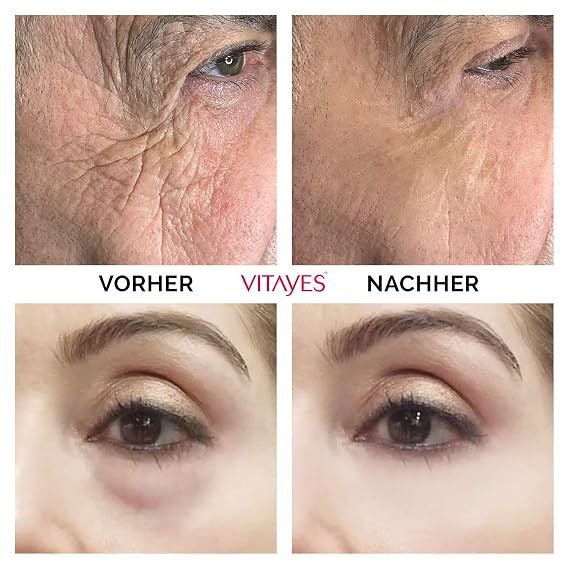 VITAYES كريم رفع Ageback الفوري ، أكياس الدائرة المظلمة تحت مزيل العين ، كريم رفع الوجه المضاد للتجاعيد والخطوط الدقيقة 0.24 Oz