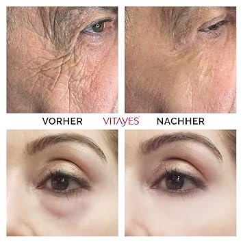 VITAYES كريم رفع Ageback الفوري ، أكياس الدائرة المظلمة تحت مزيل العين ، كريم رفع الوجه المضاد للتجاعيد والخطوط الدقيقة 0.24 Oz