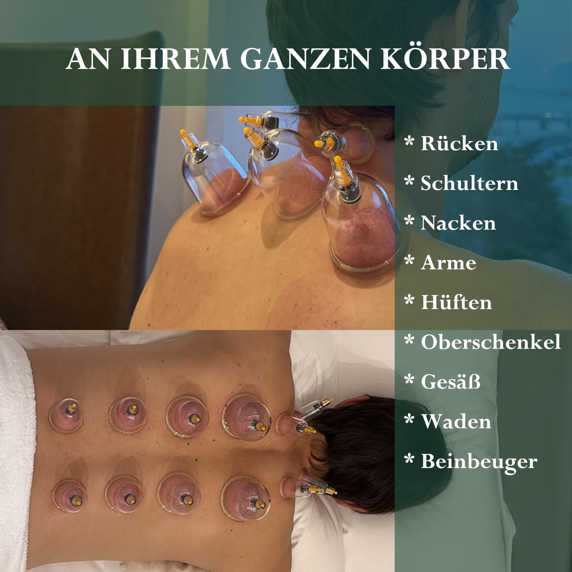 Uplife Schröpfgläser mit Vakuumpumpe - Schröpfset mit Gläsern für Schröpfen & Cupping Therapie - Schröpfgerät & Massage Set Physiotherapie Zubehör - Cupping Set (12 stück)