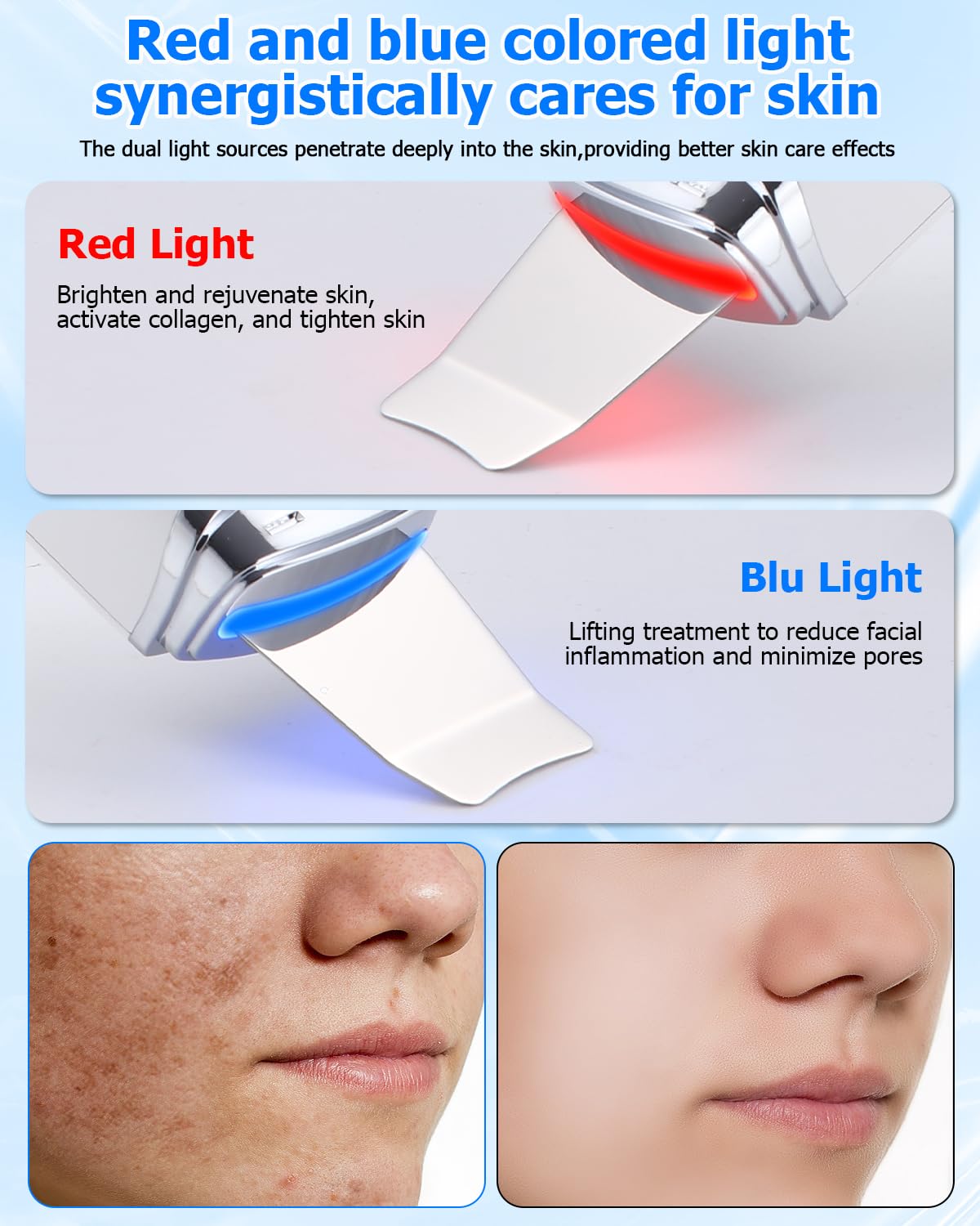 Pulizia Viso Ultrasuoni, Viene Fornito con 4 Modalità Viso e Intensità Regolabile, Skin Scrubber, Luce Rossa e Blu, Display LED e Funzione di Spegnimento Automatico, Skin Scrubber Ultrasuoni