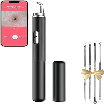 Blackhead Remover with Camera, WiFi Visual Blackhead Remover Tools with White/Blue Lights for iPhone, Android Phones Women Gift