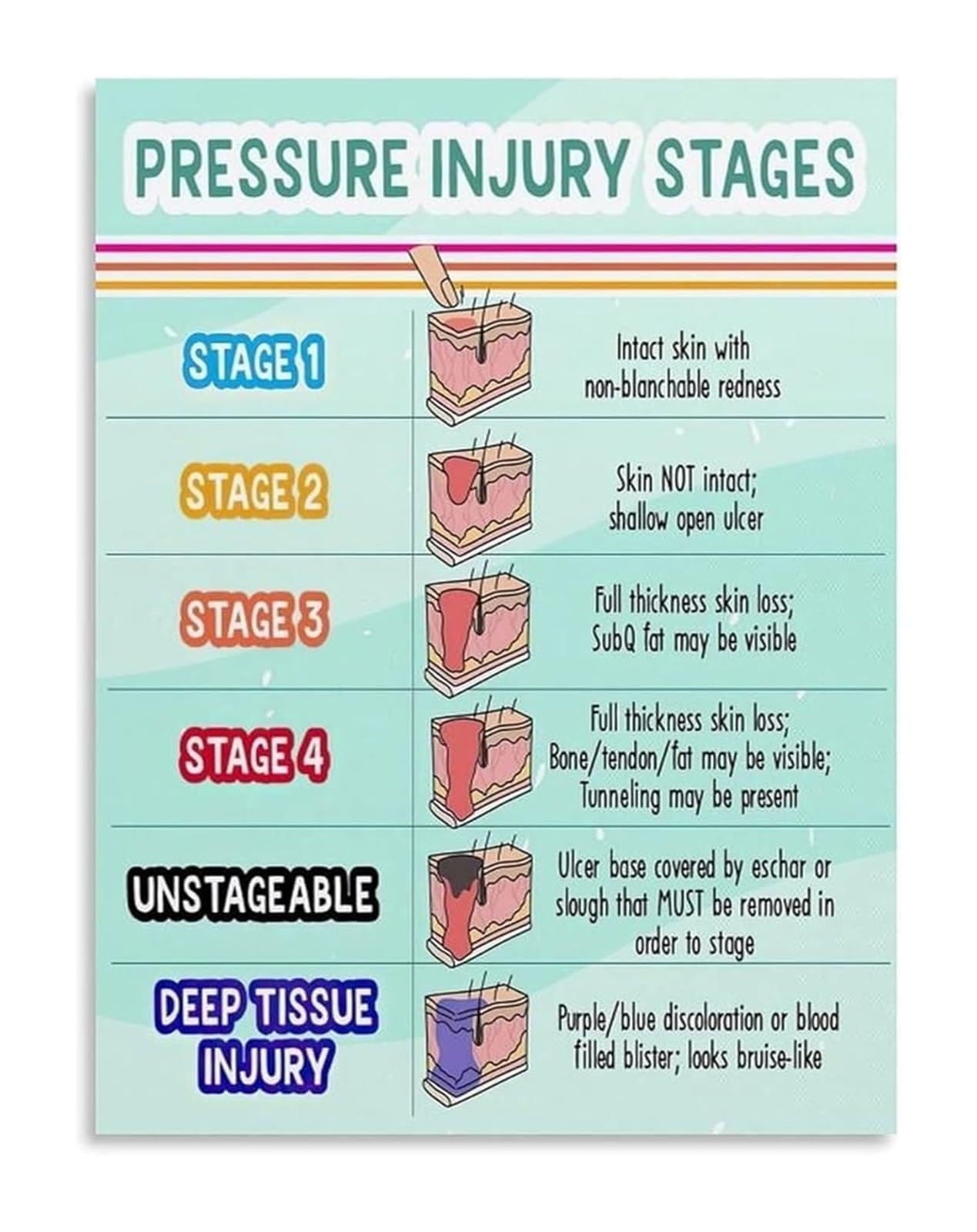 MQXFCZUX Wound Care Pressure Ulcer Stages Metal Sign Nursing Student Guide Clinical Reference Poster for Healthcare Professionals 8 X 12 in