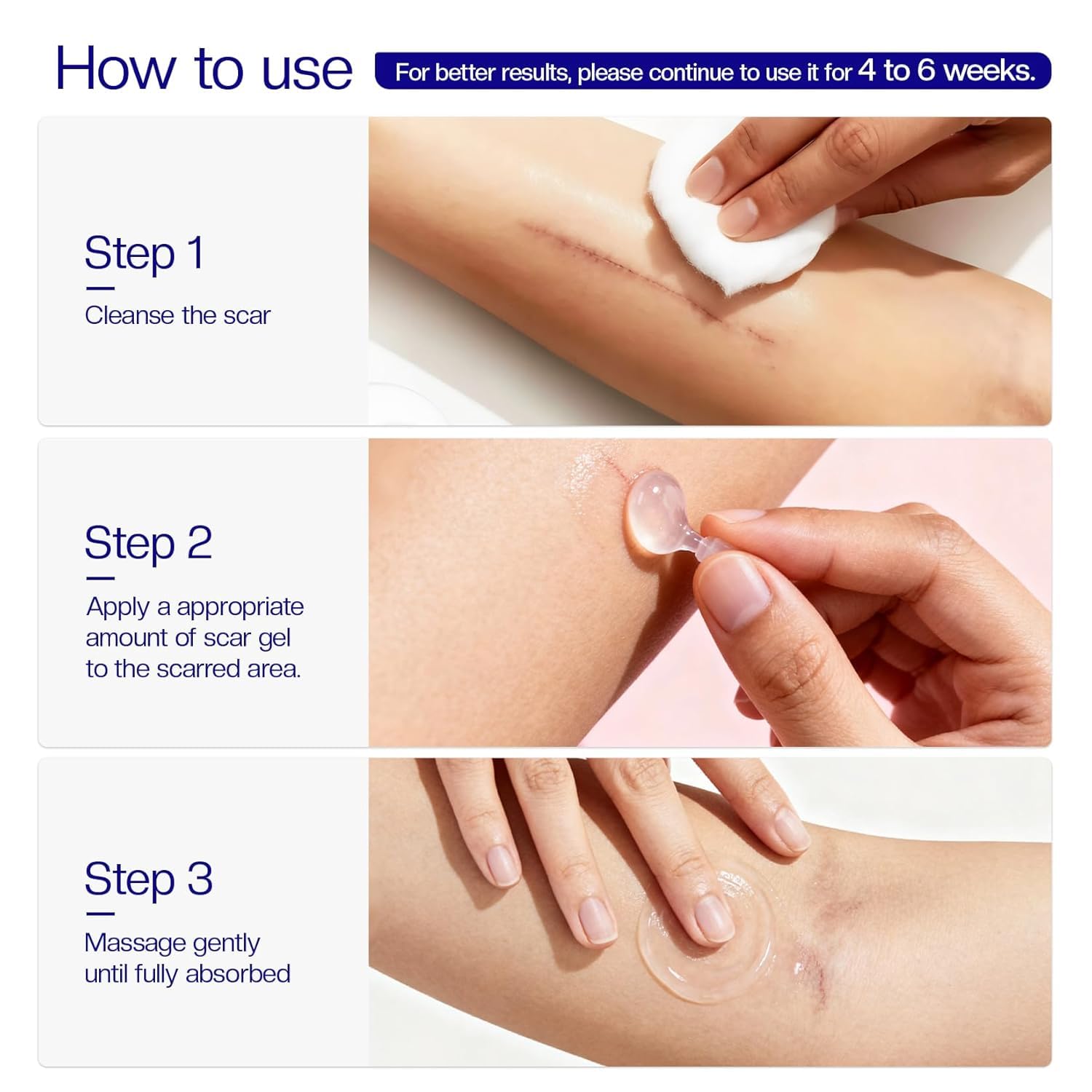 Morovan silicone scar removal Gel: Scar cream for Body and face Effectively minimizes the appearance of Scars from Stretch Marks Surgical Scar Keloids Acne Burns and Other, New scar 6 weeks - Image 7