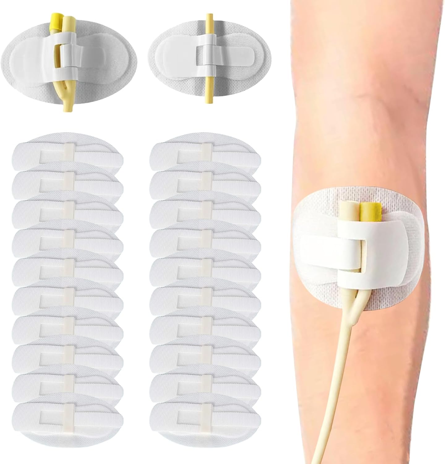 20Pcs Foley Catheter Stabilization Device, Catheter Tube Holder, Adhesive Catheter Urinary Leg Bag Legband Holder Catheter Supplies for Single/Double Tube, G Tube and Feeding Tube in Place
