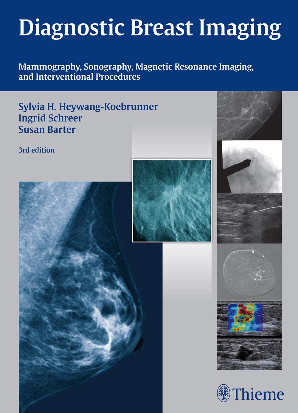 Diagnostic Breast Imaging Mammography, Sonography, MRI and