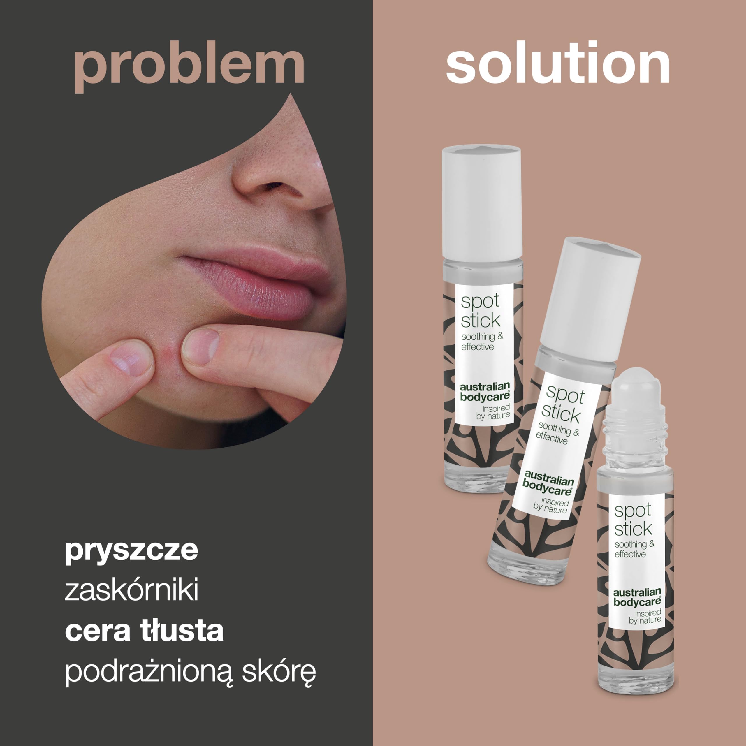Australian Bodycare Spot Stick 3 x 9ml | Roll-on na niedoskonałości skóry | Działa kojąco i oczyszczająco na pryszcze, zaskórniki i inne wypryski | Z 100% naturalnym Olejkiem z Drzewa Herbacianego