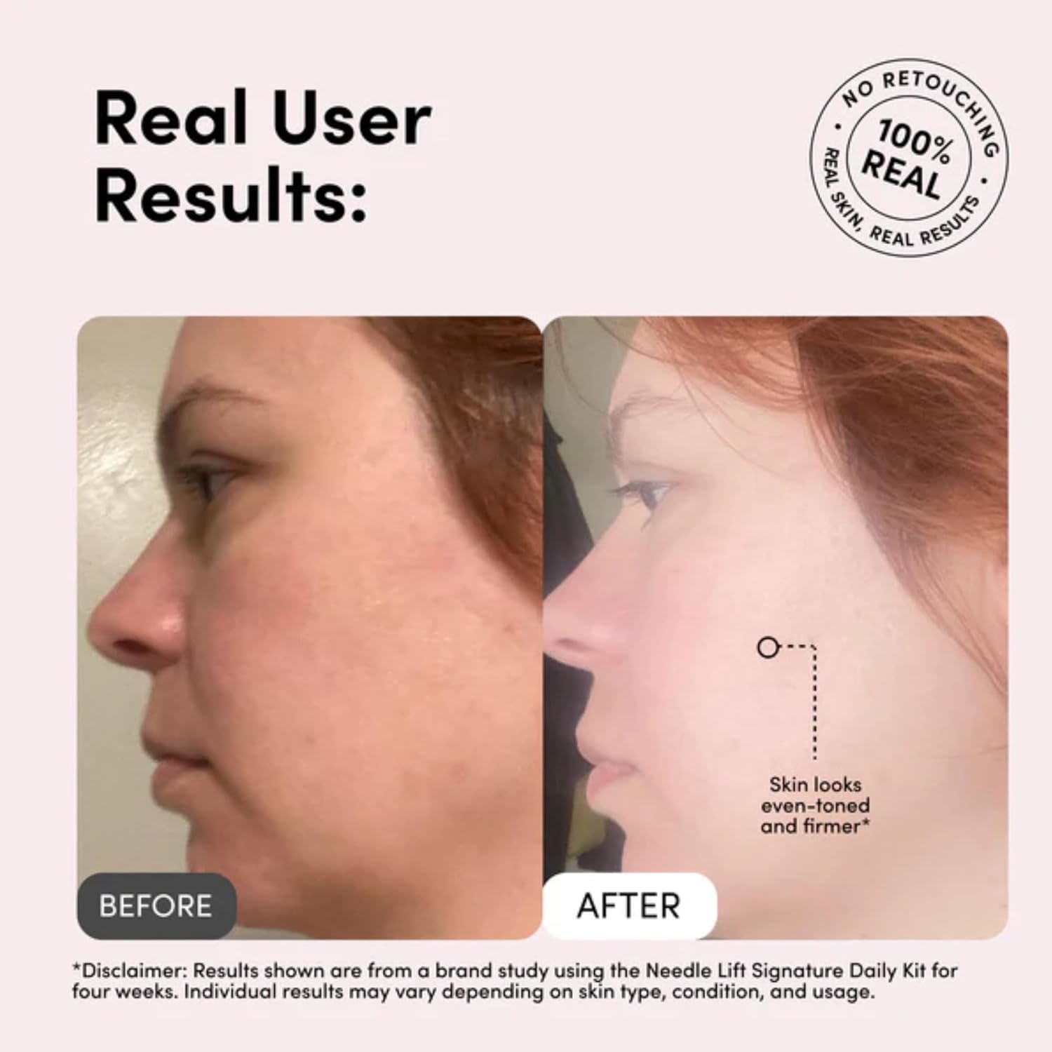 MEDI LIFT NL Signature Cream - Anti Aging Face Cream with Micro-Spicule Technology, Collagen & Hyaluronic Acid, Anti Wrinkle Skin-Perfecting Hydro Boost Moisturizer for Women, 0.8 oz / 25g