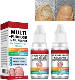 2 PCS Fungal Nail Treatment for Toenails Extra Strong,Nail Fungus Treatment for Toenail,Anti Fungal Nail Treatment,Toenail Fungus Treatment,Fingernail Toenail Care,Nail Repair,Nail Growth Treatment