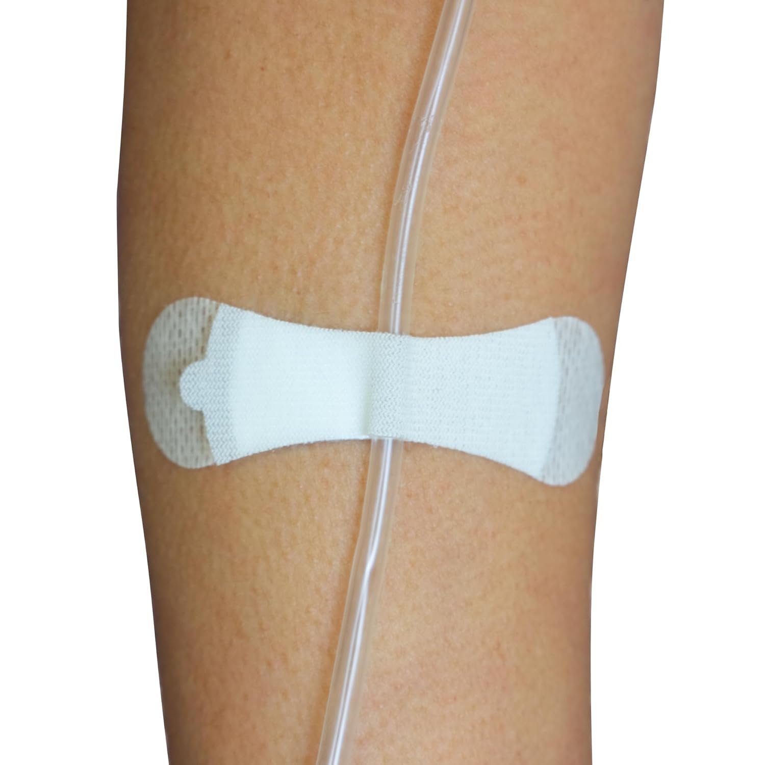 TIDI 3200S Grip-Lok Small Securement Device ― Pack of 100 ― Catheter Stabilization Device ― White ― Flexible Material ― Low-Profile Design for Comfort― Home Healthcare ― Medical Supplies