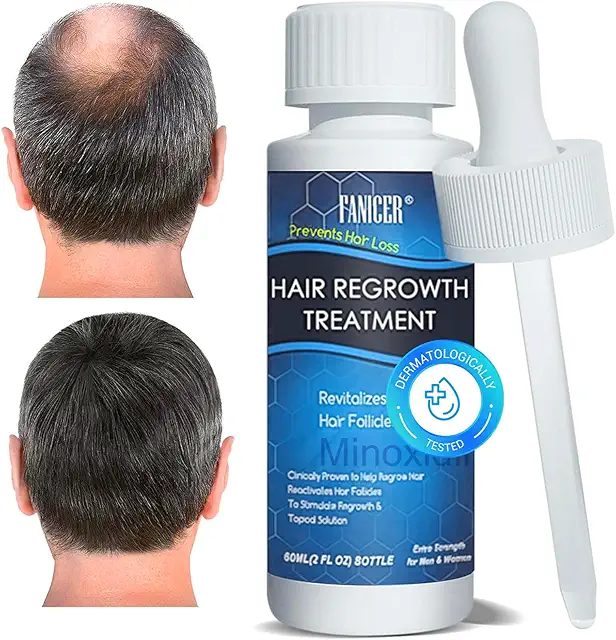 Sérum Anti Chute Cheveux 60ml - Minoxidil pour Femme et Homme