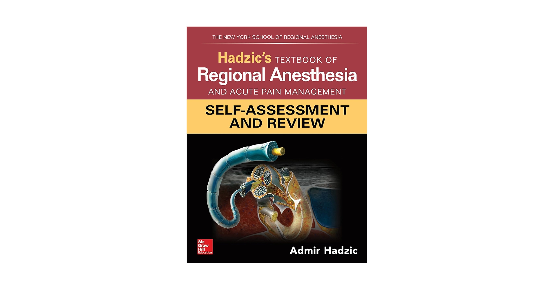 健康・医学 MCQs in Regional Anaesthesia and Pain Th Mcqs in Regional Anaesthesia and Pain Therapy (MasterPass