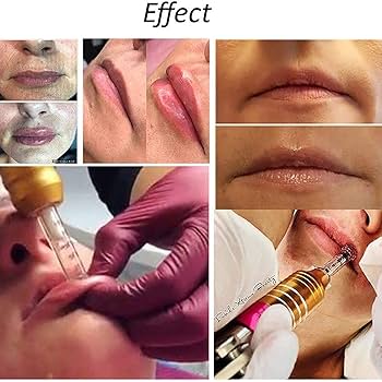 ヒアルロン酸ペン ゴールド カートリッジ付き 71lvMrkP76L._UF350,350_QL50_.jpg