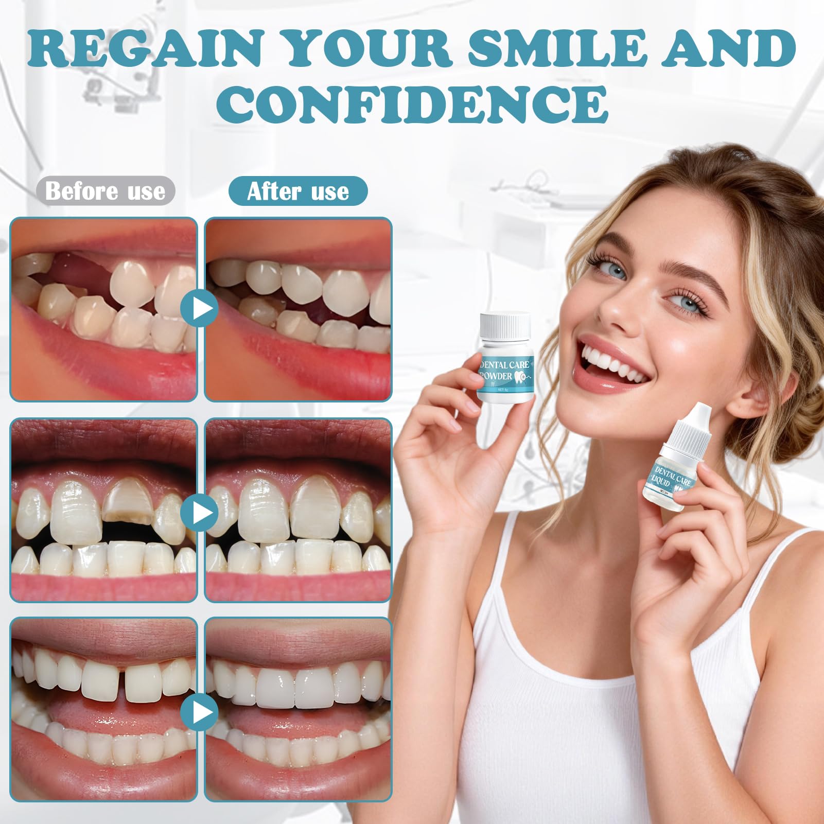 Pegamento Dental Cemento Kit de Fijación para Corona Puente Rellenar Caries