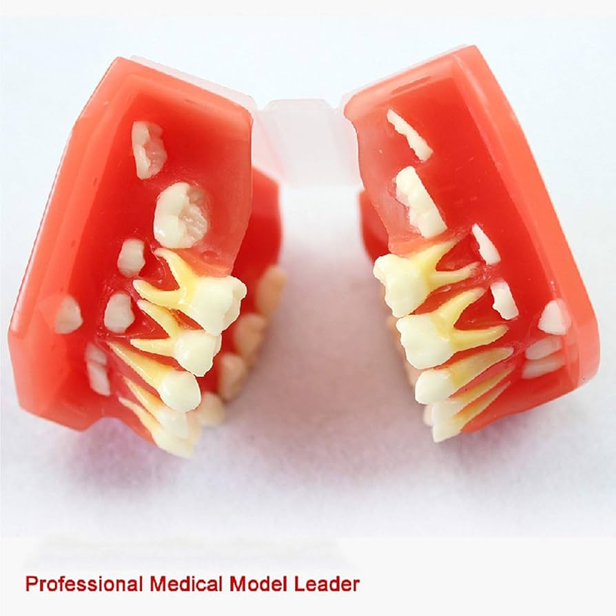 歯のモデル　発育模型 Amazon.co.jp: 子供の歯科模型、子供の乳歯の発育歯列モデル