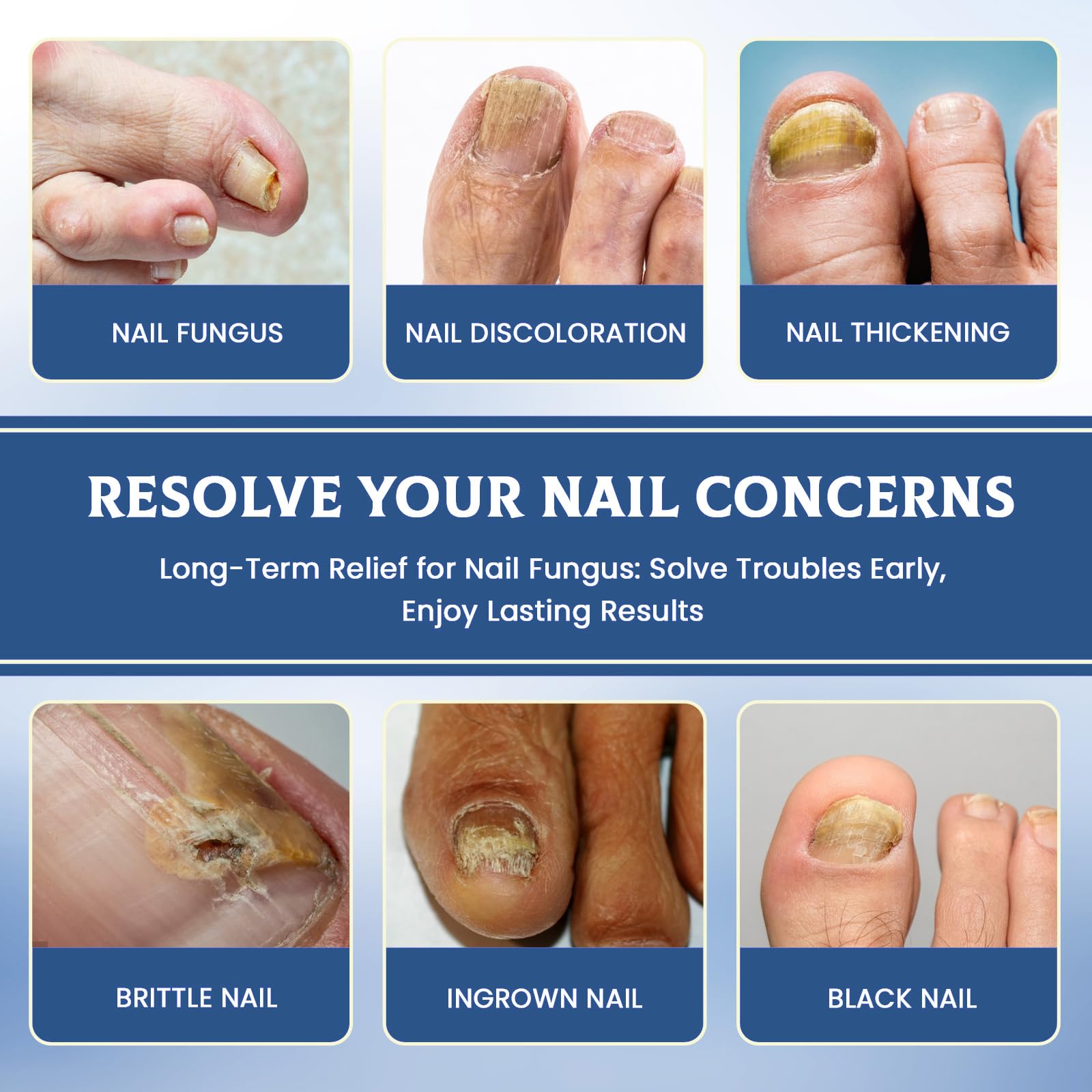 32 Pcs Fungal Nail Patches,Toenail Fungus Treatment Extra Strength - Toe Nail Fungus Treatments for Men and Women, Overnight Renewal Nail Repair Patches - 3