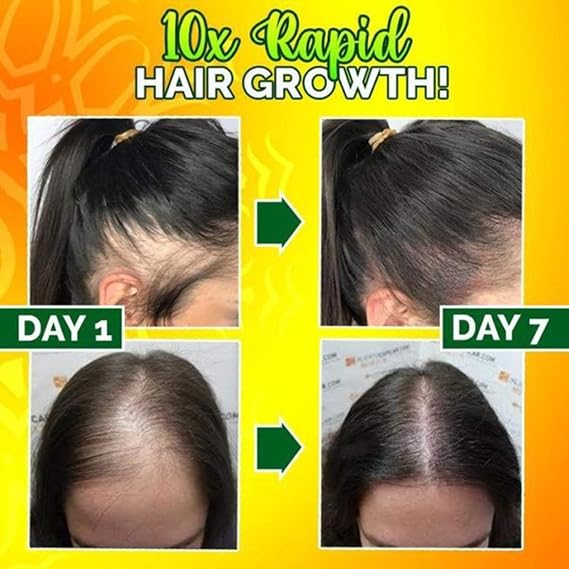 2pcs Strong Hair Serum Rapid Growth Hair Treatment-Hair Growth Serum,Strengthen Hair Roots,Visibly Increase Hair Density,Repairs Hair Follicles