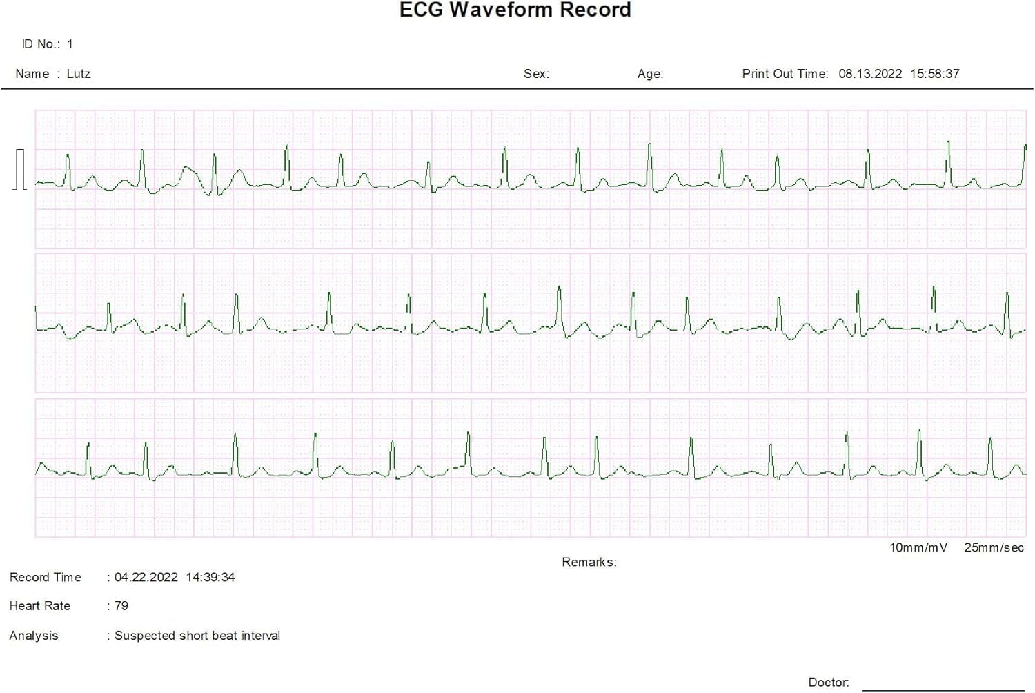 Tragbares EKG Gerät Bluetooth 30 Sekunden Handmessung-Langzeit Messung 22 Stunden mit EKG Kabel für zu Hause Vorhofflimmern-inkl. PC Auswertungssoftware ausdrucken - Deutsche Anleitung