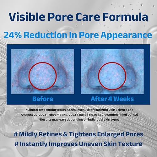 Miniatura 3 de ACNIOME Derma - Crema humectante, crema de gel para el cuidado diario de los poros de ácido salicílico, hidratante no pegajosa con ácido hialurónico