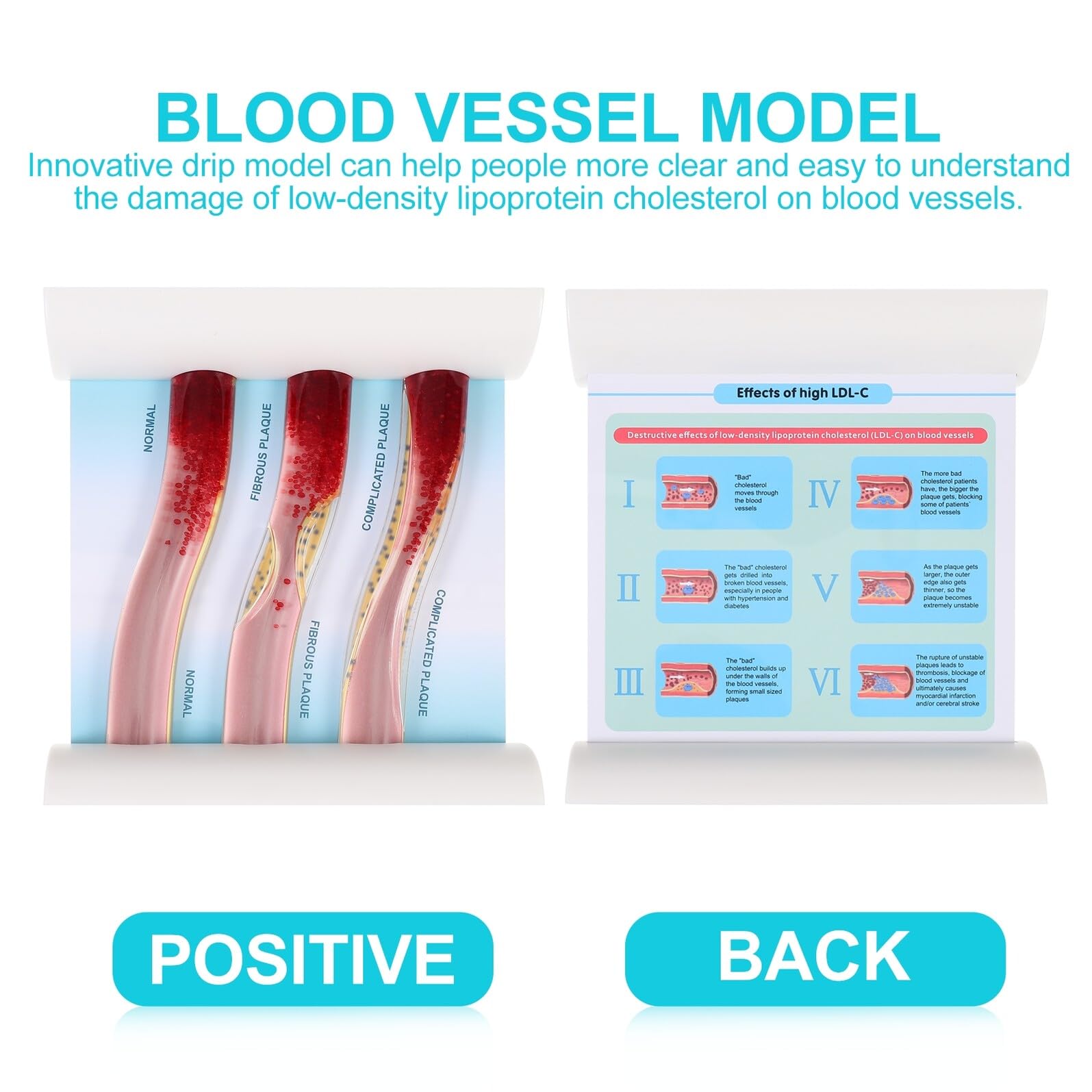Veemoon Dynamisches Blutgefäßmodell aus Kunststoff Anatomisches Lehrmodell Lebensnah Realistische Simulation für Medizinstudierende und Fachkräfte