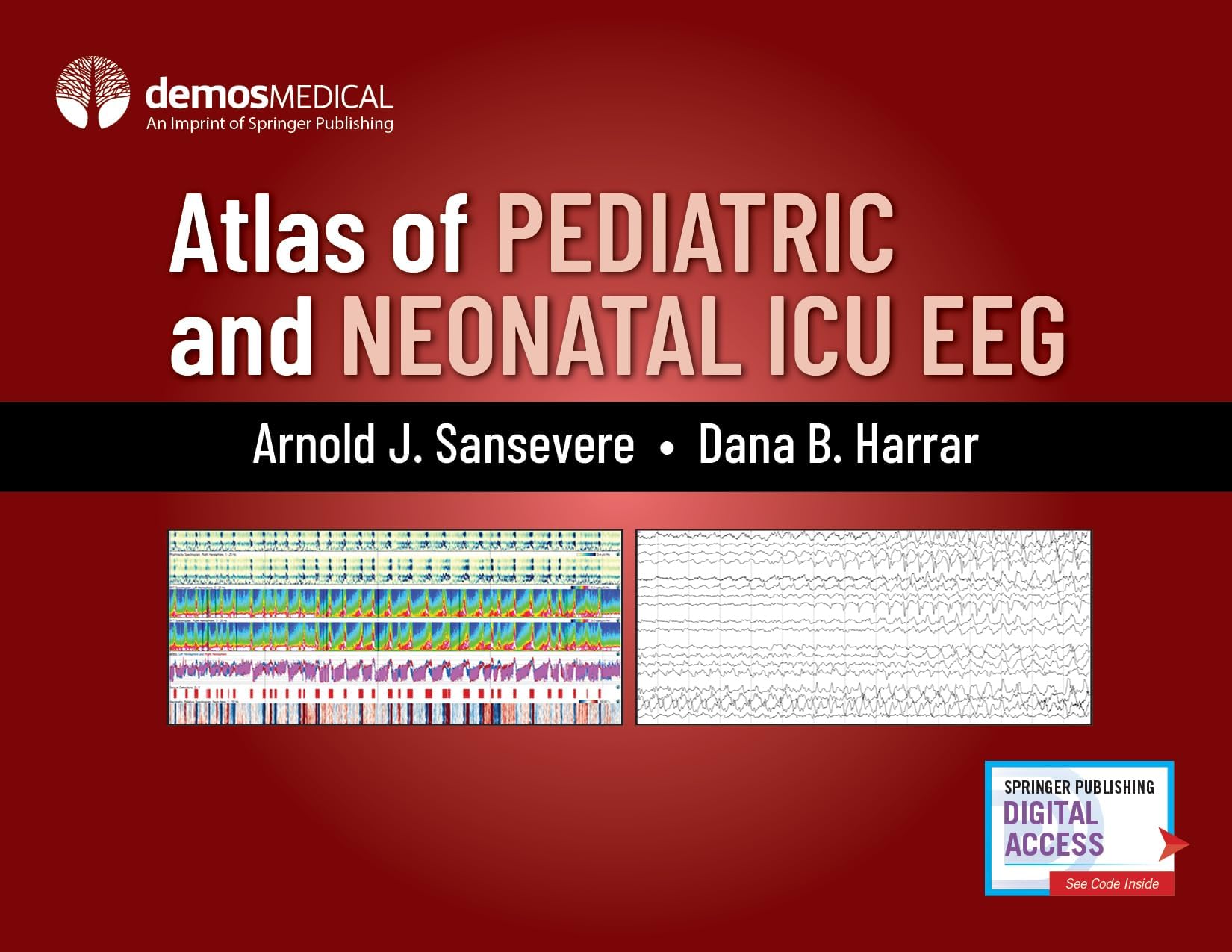 Springer Publishing Co Inc Atlas of Pediatric and Neonatal ICU EEG