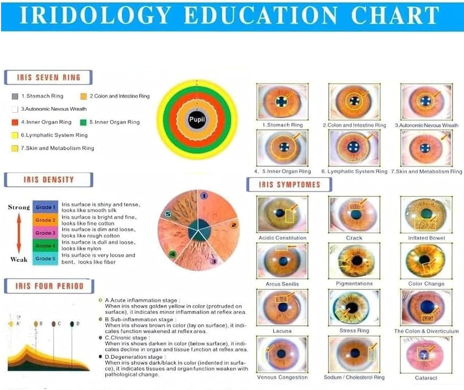 Iris Analyzer Iridology Camera, Multi-Function Iris Analysis Software, USB Iris Analyzer Iridology Camera, Iriscope iridology Camera iris Analyzer for Body Health Diagnosis