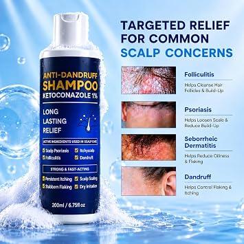 Ketoconazole 1% Anti-Dandruff Shampoo Itchy Scalp Flake Control 200ml