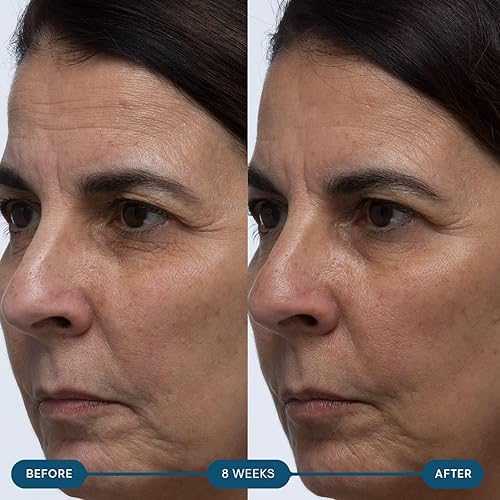 Miniatura 4 de ELEMIS Suplementos para el futuro de la piel Pro-Colágeno  Cápsulas de belleza, antienvejecimiento, relleno de piel, reafirmante, ácido hialurónico,