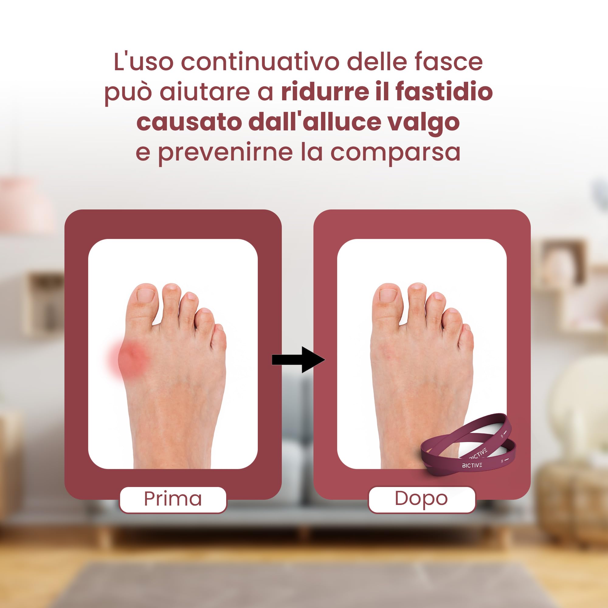 ️ Elastici per Allenarsi e Ridurre il Disagio dell'Alluce Valgo. Correttore Alluce Valgo Donna et Uomo, Separatore Dita Piede Elastico Alluce Valgo Rimedi. 3 Livelli di Resistenz