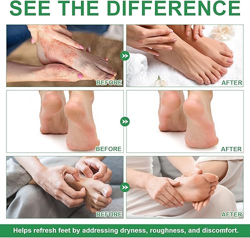 Miniatura 6 de Spray de aceite de árbol de té para pies, control de olores y alivio de picazón con aceite de árbol de té, 4 onzas, desodorante natural para pies