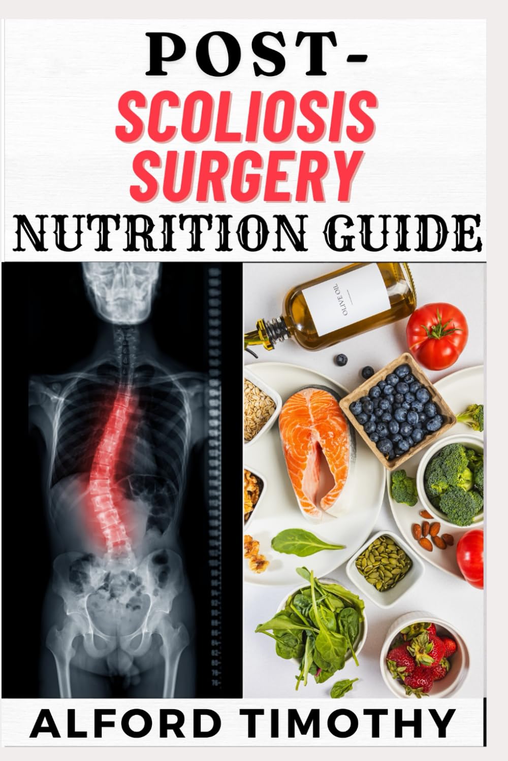 POST-SCOLIOSIS SURGERY NUTRITION GUIDE: Fueling Recovery: The Complete Nutritional Guide for Optimal Healing
