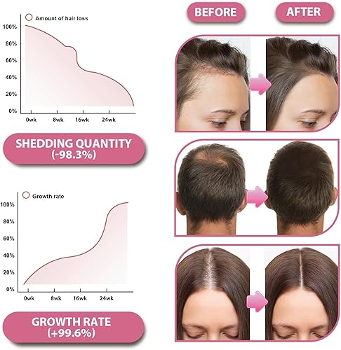 Miniatura 6 de Gomitas veganas para el crecimiento del cabello, 120 unidades clínicamente probadas para un cabello más grueso y lleno  Minerales multivitamínicos