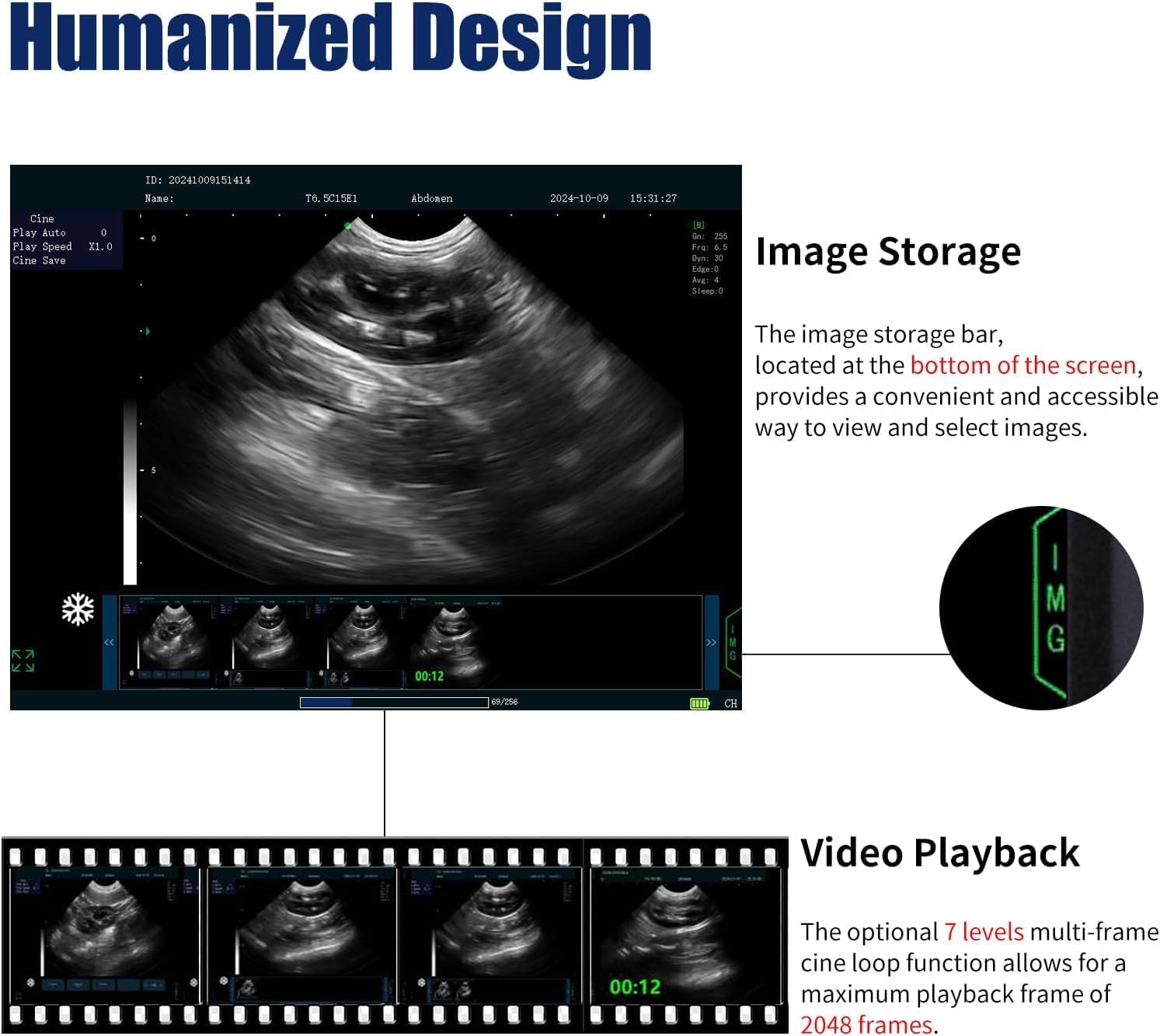 N60 Portable Veterinary Ultrasound Machine, PC-Based Ultrasound Systems, 15" High-Resolution LCD, for Dogs, Cats, Sheep Pregnancy Check, PW Function Available (Convex Probe)
