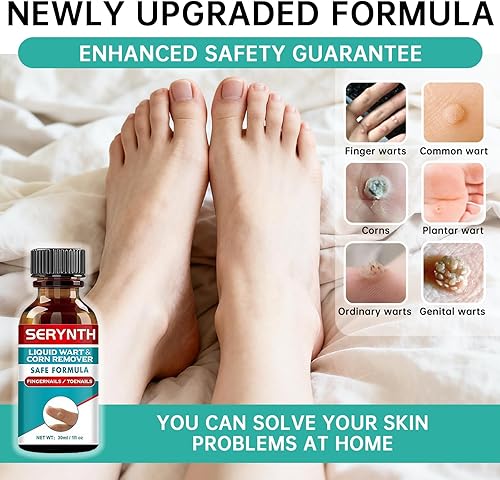 Miniatura 2 de SERYNTH Removedor de verrugas de ácido salicílico, potente fórmula de congelación líquida para eliminar verrugas, rápida y sin dolor para eliminar