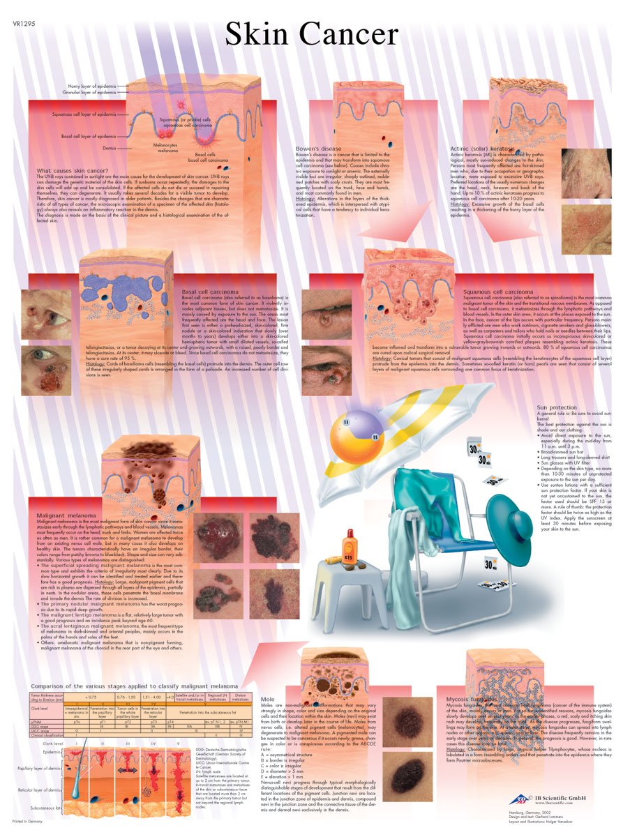 3B Scientific Human Anatomy - Skin Cancer Chart, Laminated Version