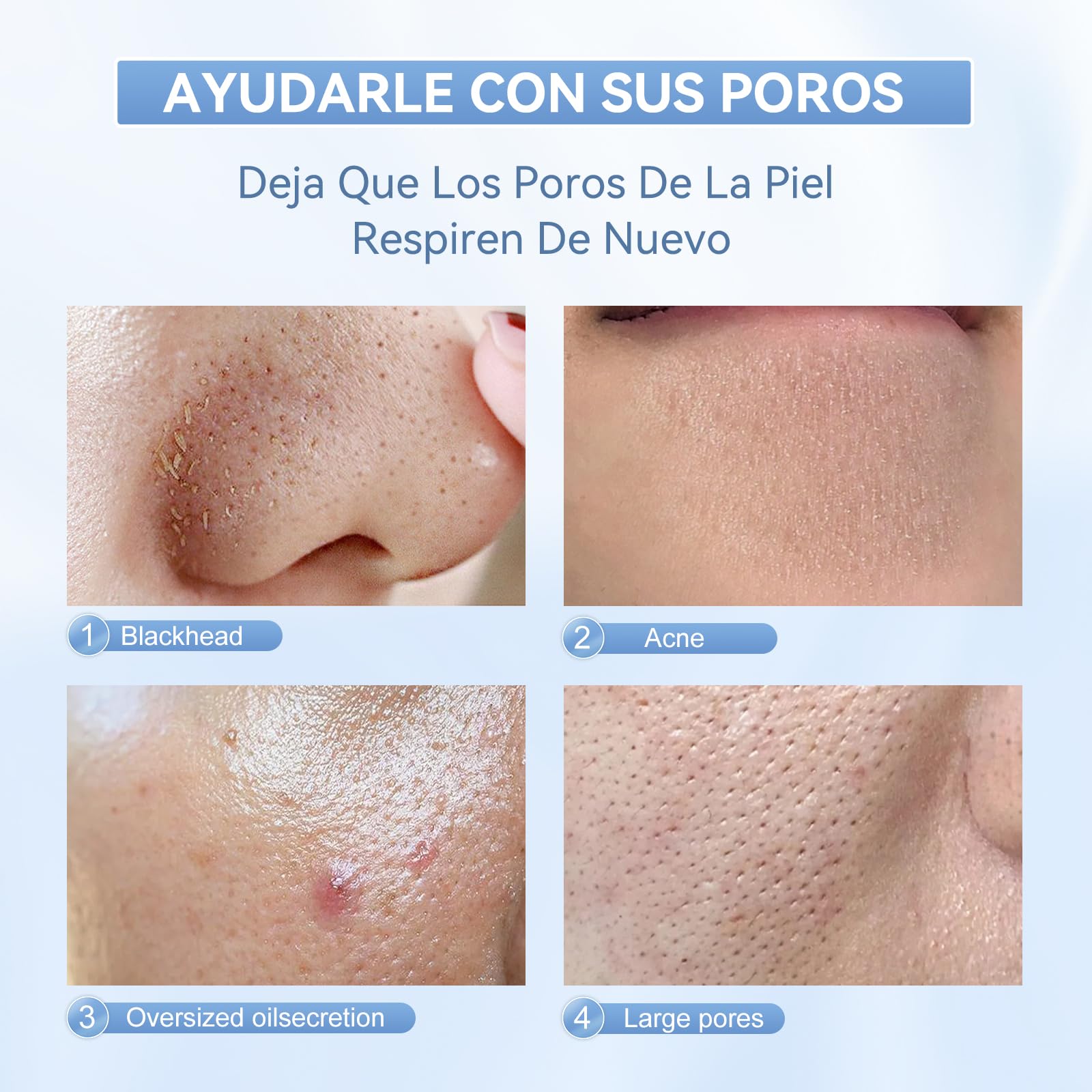 Anlan Peeling Ultrasonico Facial, Skin Scrubber, Espatula Ultrasonica Facial, Ultrasonico Facial, Roja Y Azul Led, Ems Antiedad Arrugas, Exfoliador Limpiador De Poros, Ipx7