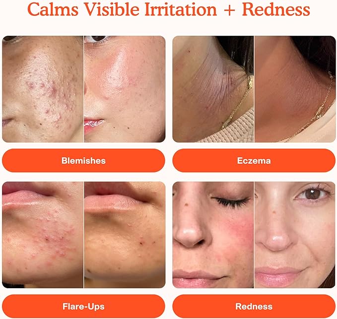 Tower 28 SOS Daily Rescue Facial Spray: Sensitive Skin Soother